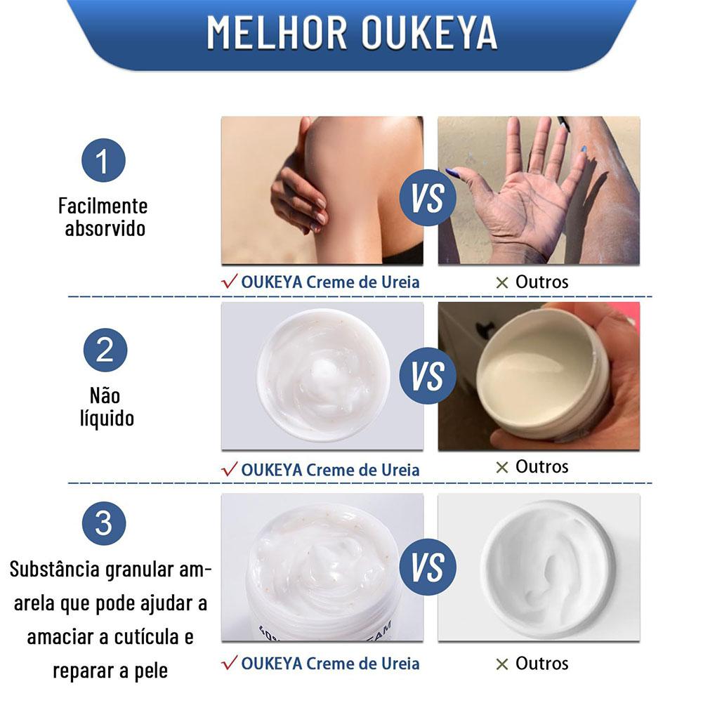 尿素クリーム 40% 保湿アンチドライハンドフットクリーム  - Urea Foot Cream のレビューと価格
