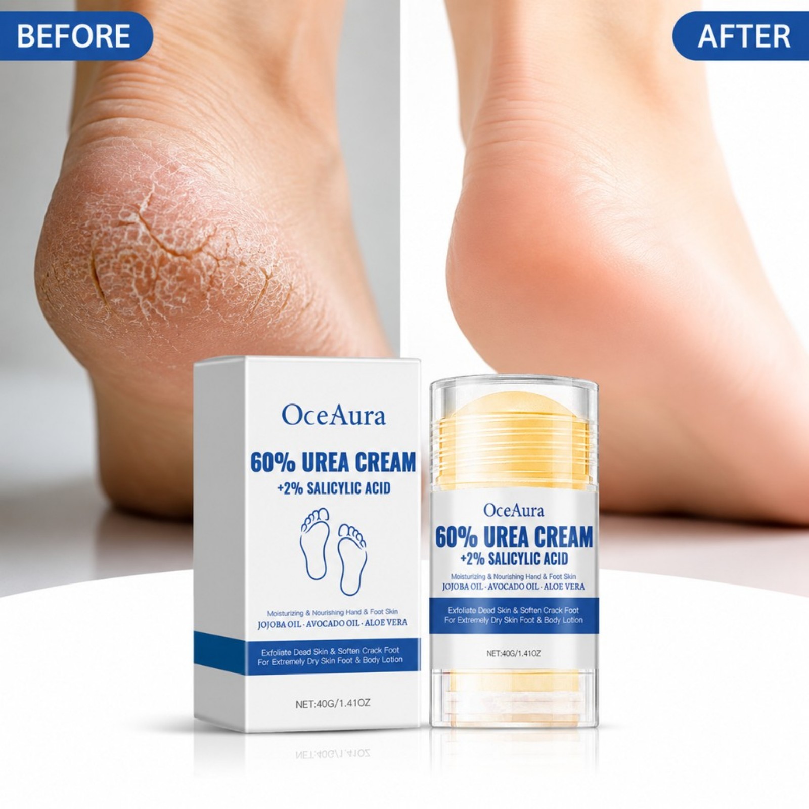60%尿素配合フットケアクリームスティック 保湿＆角質除去  - Urea Foot Cream のレビューと価格
