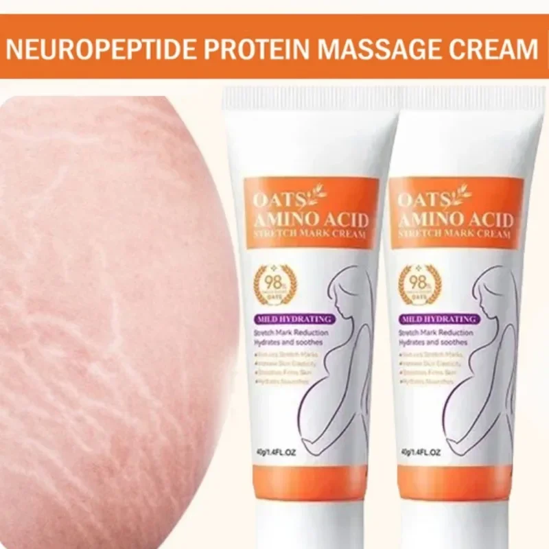 ストレッチマーク永久除去クリーム 体の腹部のストレッチマーク - Skincare Oat のレビューと価格